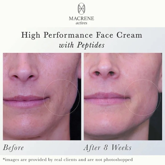 NEW MACRENE actives Moisturizing High Performance Face Cream - Picture 7 of 7